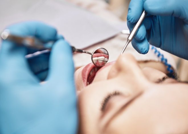 How Veneers Adapt to Your Unique Bite Pattern for Optimal Comfort