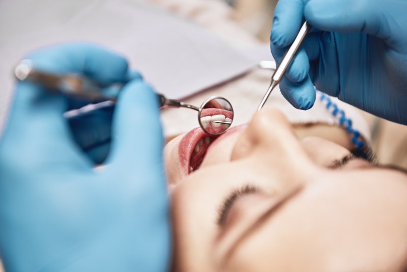 How Veneers Adapt to Your Unique Bite Pattern for Optimal Comfort