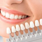How Veneers Can Influence Jaw Alignment and Reduce Tension Headaches